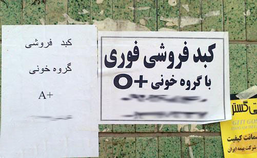 ماجرای فروش کبد ۵۰۰ میلیونی در تهران صحت دارد؟