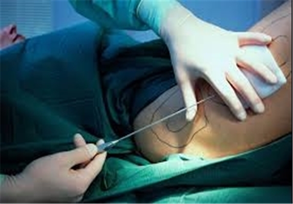 حقایقی از یک تجارت سیاه و پردرآمد با با انتشار تصاویر (۱۸+)