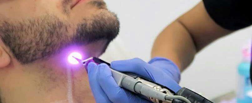 چه کسانی نباید لیزر کنند؟
