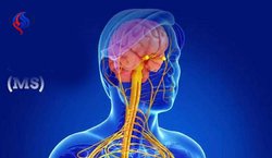 ارائه خدمات درمانی رایگان به بیماران مبتلا به ام اس