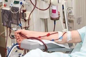وجود ۳۰ هزار بیمار دیالیز خونی در کشور/ یک هزار و ۶۰۰ بیمار دیالیز صفاقی خدمت دریافت می‌کنند