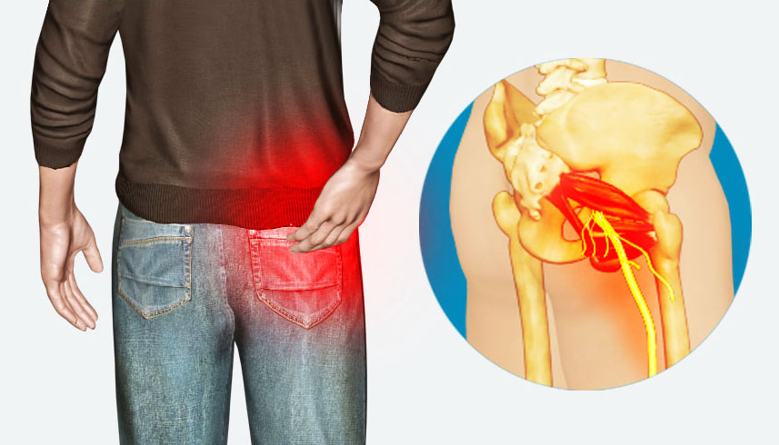 کنترل دردهای شدید در ناحیه&zwnj;ی پا و کمر