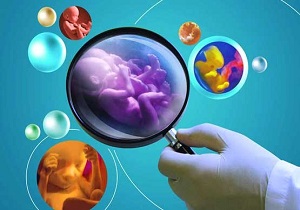 غربالگری ۲۳۲۸ زوج بیرجندی در طرح ژنتیک قبل از بارداری