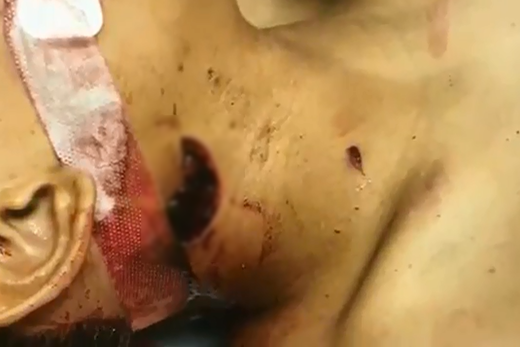 اراذل و اوباش آمریکایی گلوی پسر ۱۵ ساله را شکافتند! +فیلم