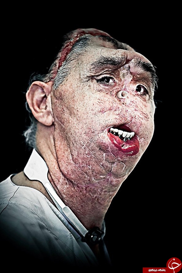 این اشخاص نیاز شدید به جراحی پلاستیک دارند+تصاویر(+18)