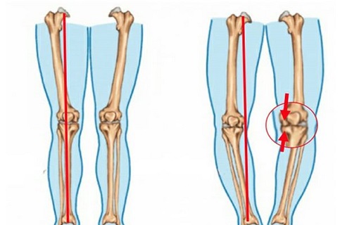 برای لاغری این ماده را از رژیم غذایی خود حذق نکنید/زانوی پرانتزی خود را به این روش درمان کنید/روغنی که به از بین بردن موهای زائد کمک می&zwnj;کند