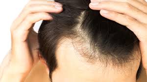چگونه از موهای خود در برابر کَلر استخر محافظت کنیم؟
