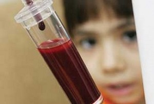 آشنایی با تالاسمی و بررسی وضعیت تالاسمی در استان خوزستان