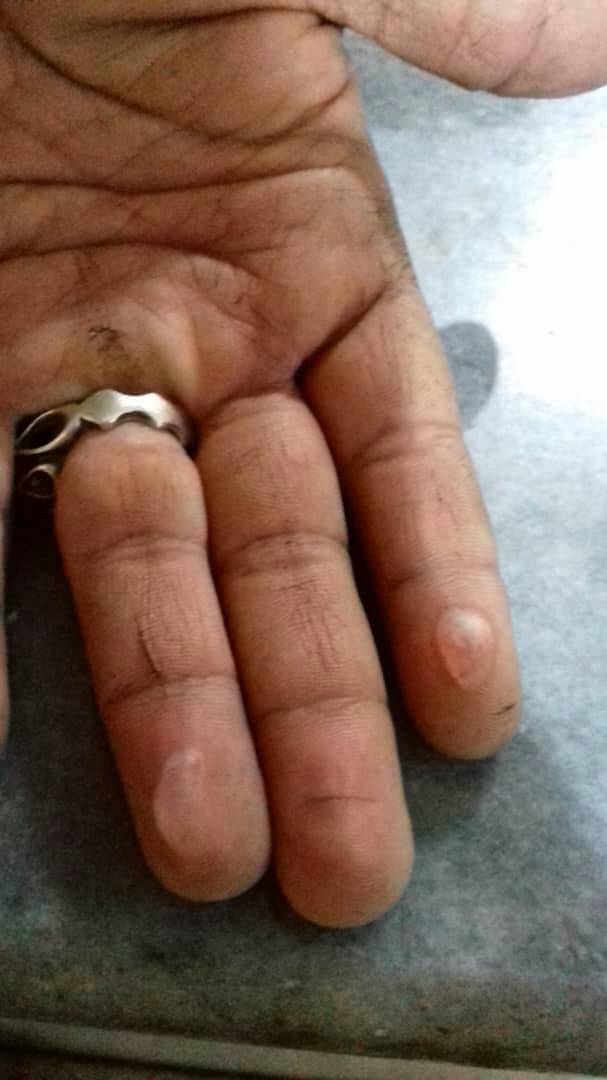 فداکاری آتش نشان دهلرانی در مهار آتش