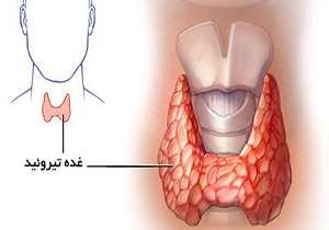 تیروئید را  جدی بگیرید