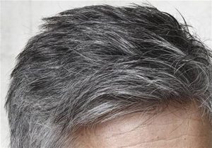 عامل اصلی سفید شدن مو چیست؟