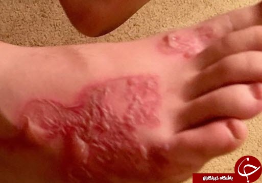 چرا نباید در شن های ساحل دریا فرو رفت؟ تصاویر چرا نباید در شن های ساحل دریا فرو رفت؟ تصاویر//