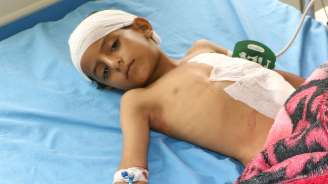 سازمان ملل: فقط یک حمله دیگر به یمن شیوع وبا را در پی خواهد داشت