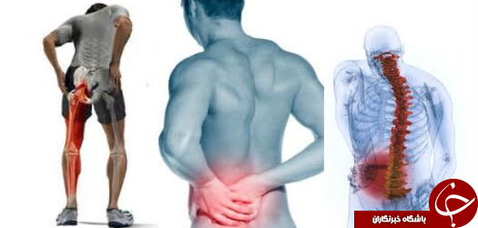 نگاهی به راه های درمان سیاتیک