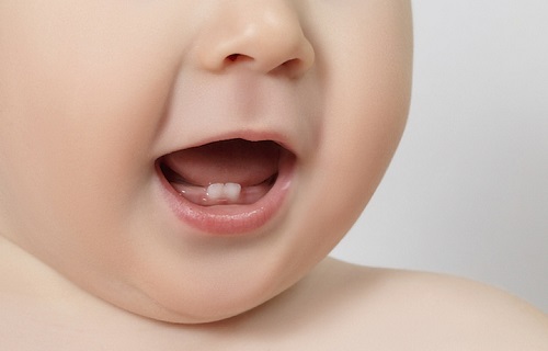 بهترین راه برای تسکین لثه&zwnj;ها&zwnj;ی ملتهب چیست؟