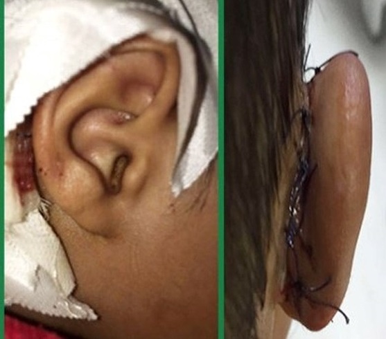 ماجرای بریدن گوش کودک کار توسط ماموران شهرداری صحت دارد؟