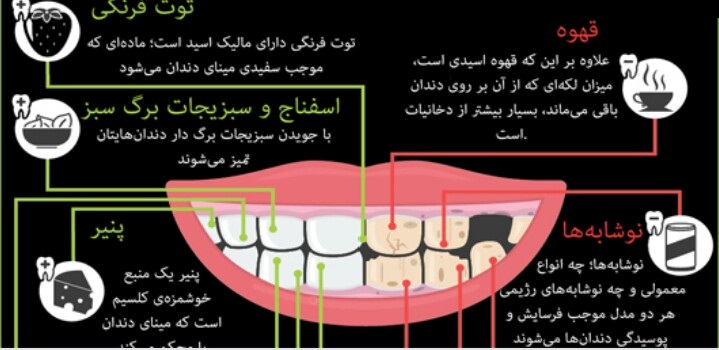 کدام مواد غذایی باعث پوسیدگی دندان می&zwnj;شود؟+ اینفوگرافی