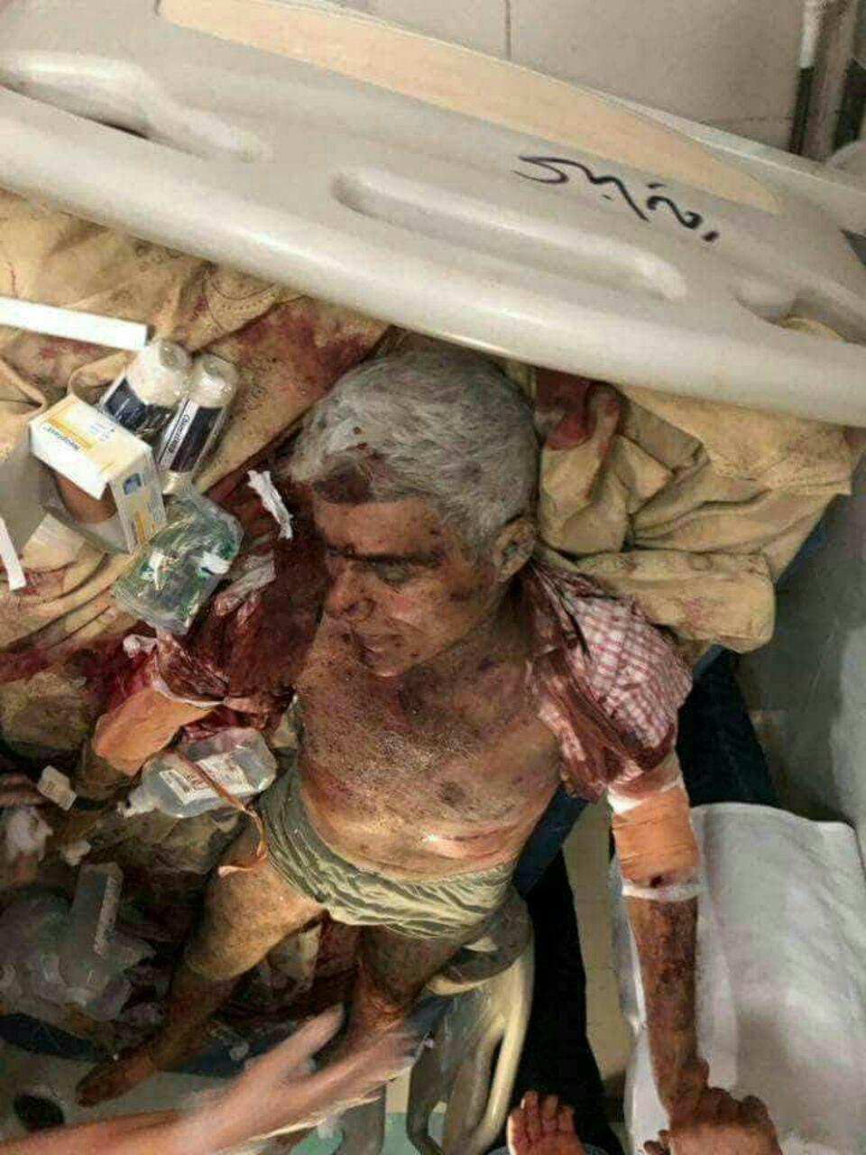 داعش یا کوموله؛ هیچ کس از خطر موشک&zwnj;های سپاه در امان نیست