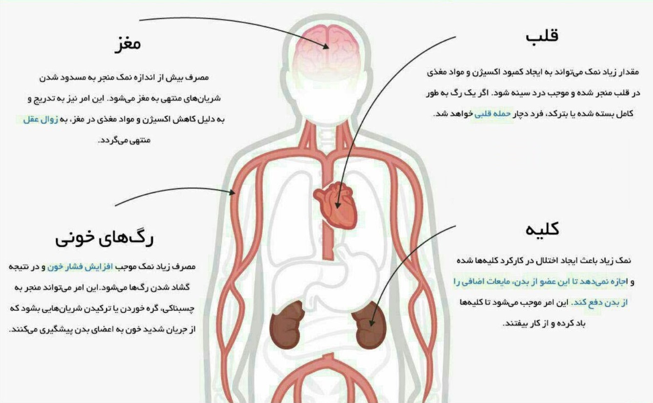 سمی سفید که در آشپزخانهها جا خوش کرده است!+ اینفوگرافی سمی سفید که در آشپزخانهها جا خوش کرده است!+ اینفوگرافی