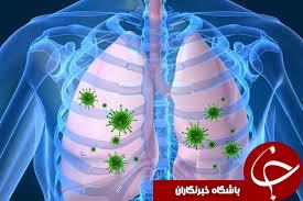 بررسی رایج ترین علائم عفونت ریه