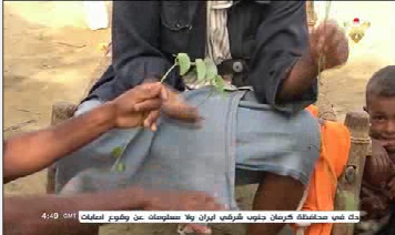 کودکان یمنی برای فرار از گرسنگی و قحطی به خوردن برگ درختان روی آورده&zwnj;اند+ تصاویر