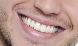 چکار کنیم دندان هایمان خراب نشود؟ +روش