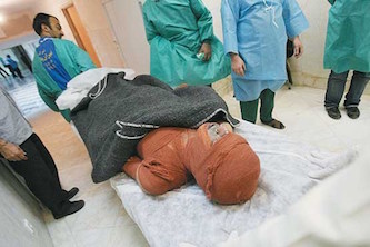 فوت ۵۷ تهرانی به دلیل سوختگی در 4 ماه نخست سال 97