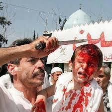 هشدار؛ خطر هپاتیت و آسیب مغزى با قمه زنى/بدعتى که جان عزاداران حسینى را تهدید مى کند