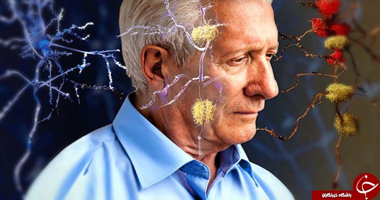 نگاهی به علائم کمبود زینک در بدن