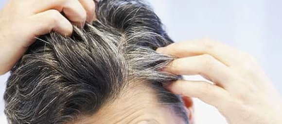 برای جلوگیری از سفیدی مو باید چه کارهایی انجام  دهیم؟