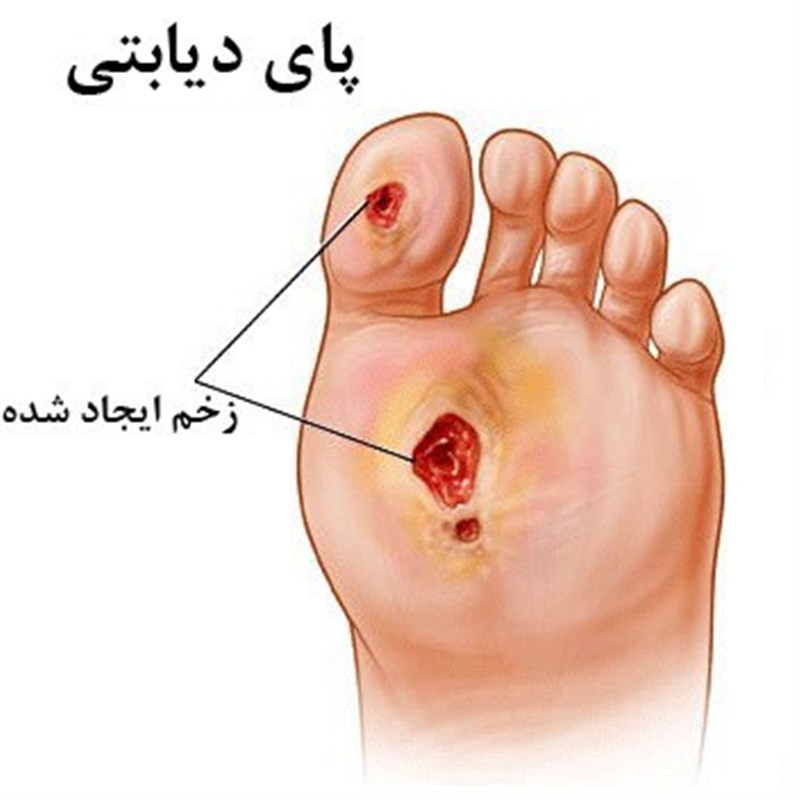 ارائه راهکار برای بهبود تأثیرات زخم بر بدن/ رشد ۴۰ درصدی مقالات ارسالی به کنگره