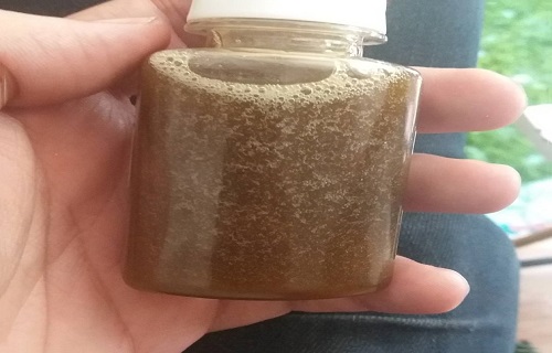 ///واریکوسـل چیست؟/