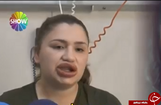 بلای وحشتناکی که پزشک قلابی سر دختر جوان آورد+تصاویر