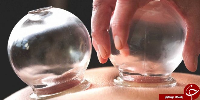 مضرات حجامت / درباره مضرات حجامت سر چه می دانید؟