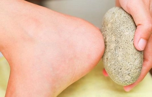 گیاهی سفید رنگ برای دستیابی به آرامش/دلایل گرفتگی عضلات چیست؟/اگر سیب زمینی سبزشده مصرف کنید دچار سردرد می&zwnj;شوید