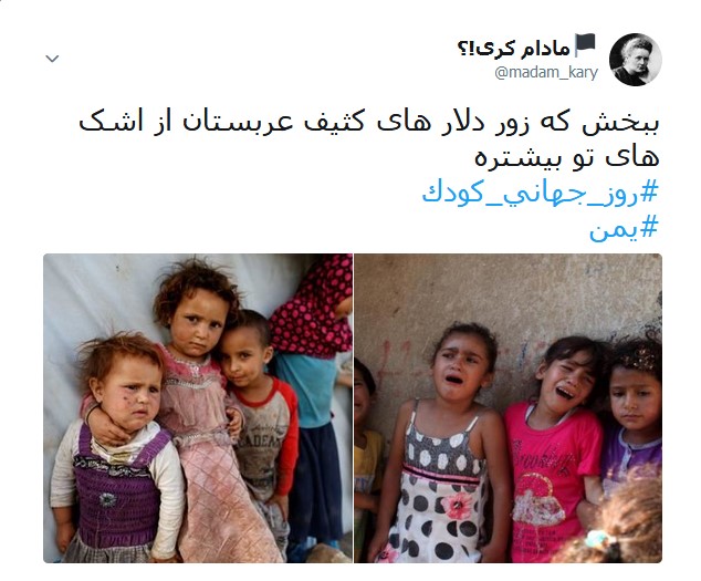 کودکان مظلوم یمنی قربانیان جنگ افروزی +تصاویر