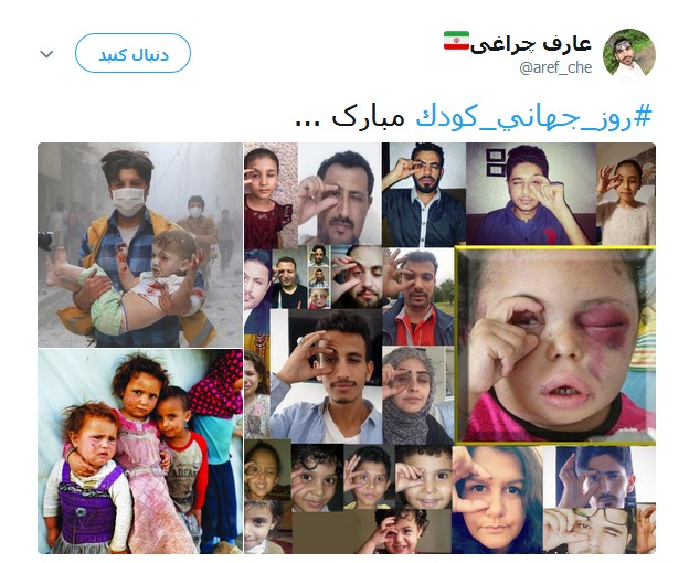 کودکان مظلوم یمنی قربانیان جنگ افروزی +تصاویر