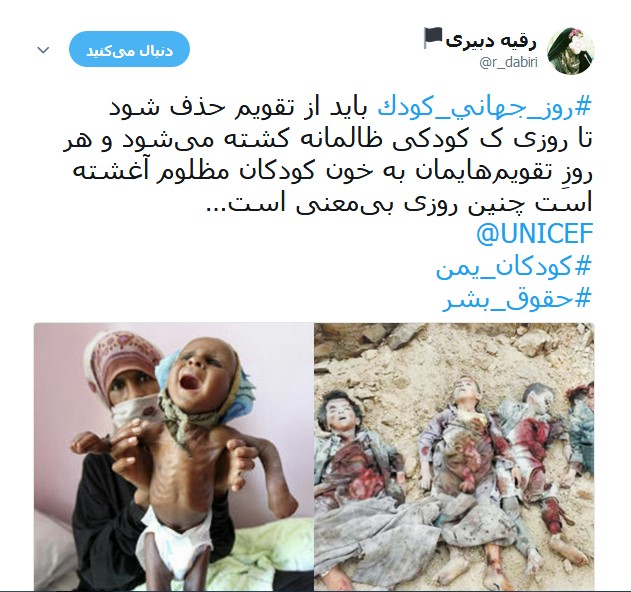 کودکان مظلوم یمنی قربانیان جنگ افروزی +تصاویر