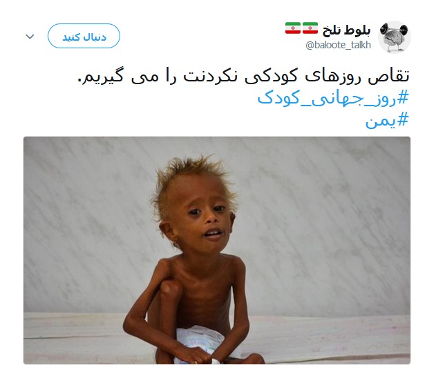 کودکان مظلوم یمنی قربانیان جنگ افروزی +تصاویر