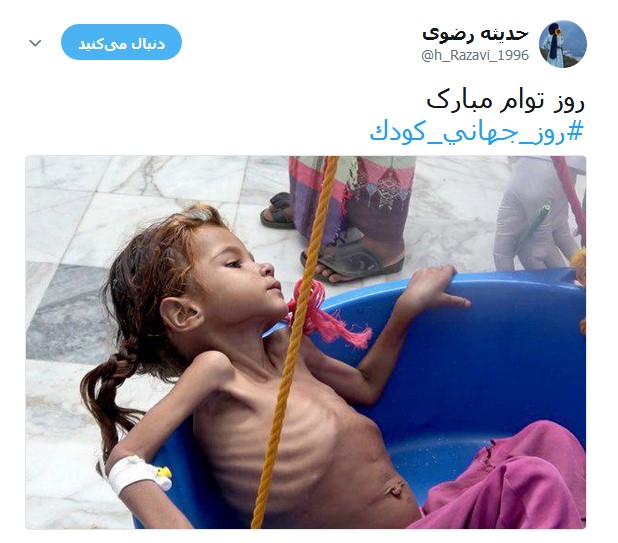 کودکان مظلوم یمنی قربانیان جنگ افروزی +تصاویر