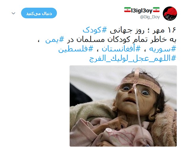 کودکان مظلوم یمنی قربانیان جنگ افروزی +تصاویر