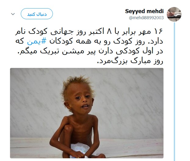 کودکان مظلوم یمنی قربانیان جنگ افروزی +تصاویر