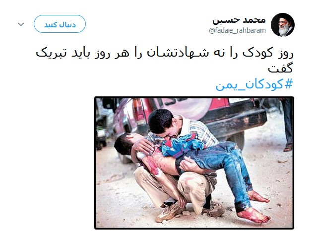 کودکان مظلوم یمنی قربانیان جنگ افروزی +تصاویر