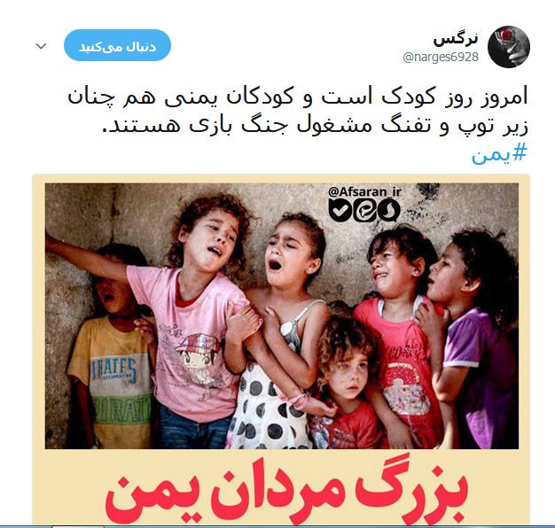 کودکان مظلوم یمنی قربانیان جنگ افروزی +تصاویر