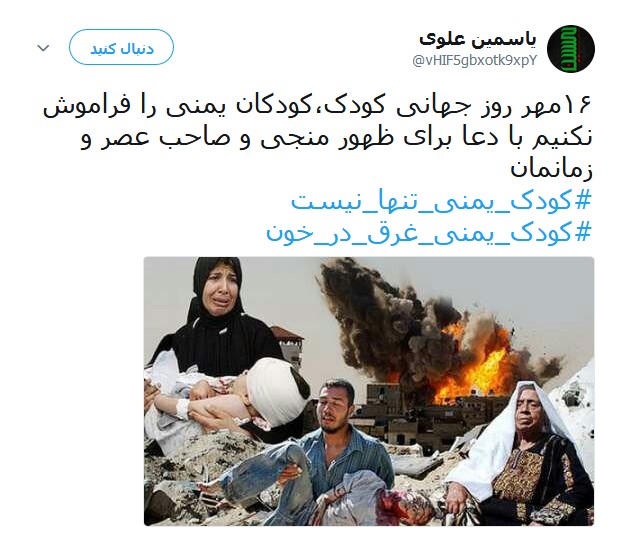 کودکان مظلوم یمنی قربانیان جنگ افروزی +تصاویر