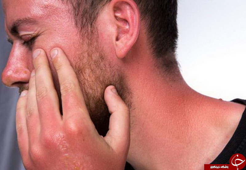 بیماری&zwnj;های مرتبط با پوسته شدن پوست را بشناسید