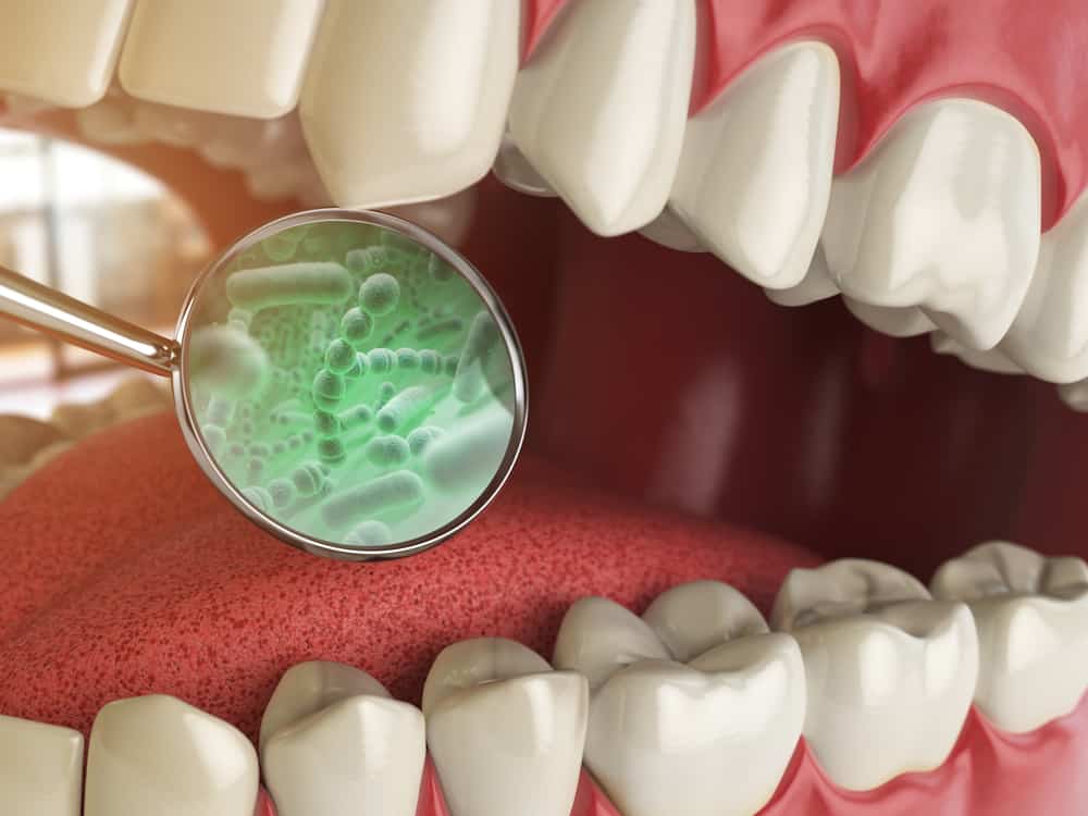 همه چیز درباره خطرات باکتری دهان برای سلامتی