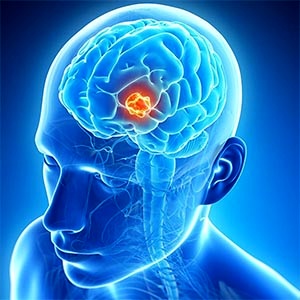 بینایی غیرطبیعی بر رشد مغز اثر می&zwnj;گذارد