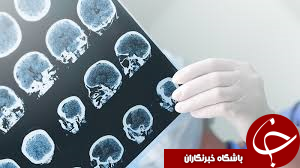 رایانه&zwnj;ها به جنگ آلزایمر و پارکینسون می روند