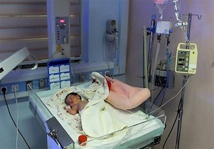 جزئیات شکافته شدن پیشانی نوزاد اصفهانی در عمل سزارین بیمارستان شهید منتظری